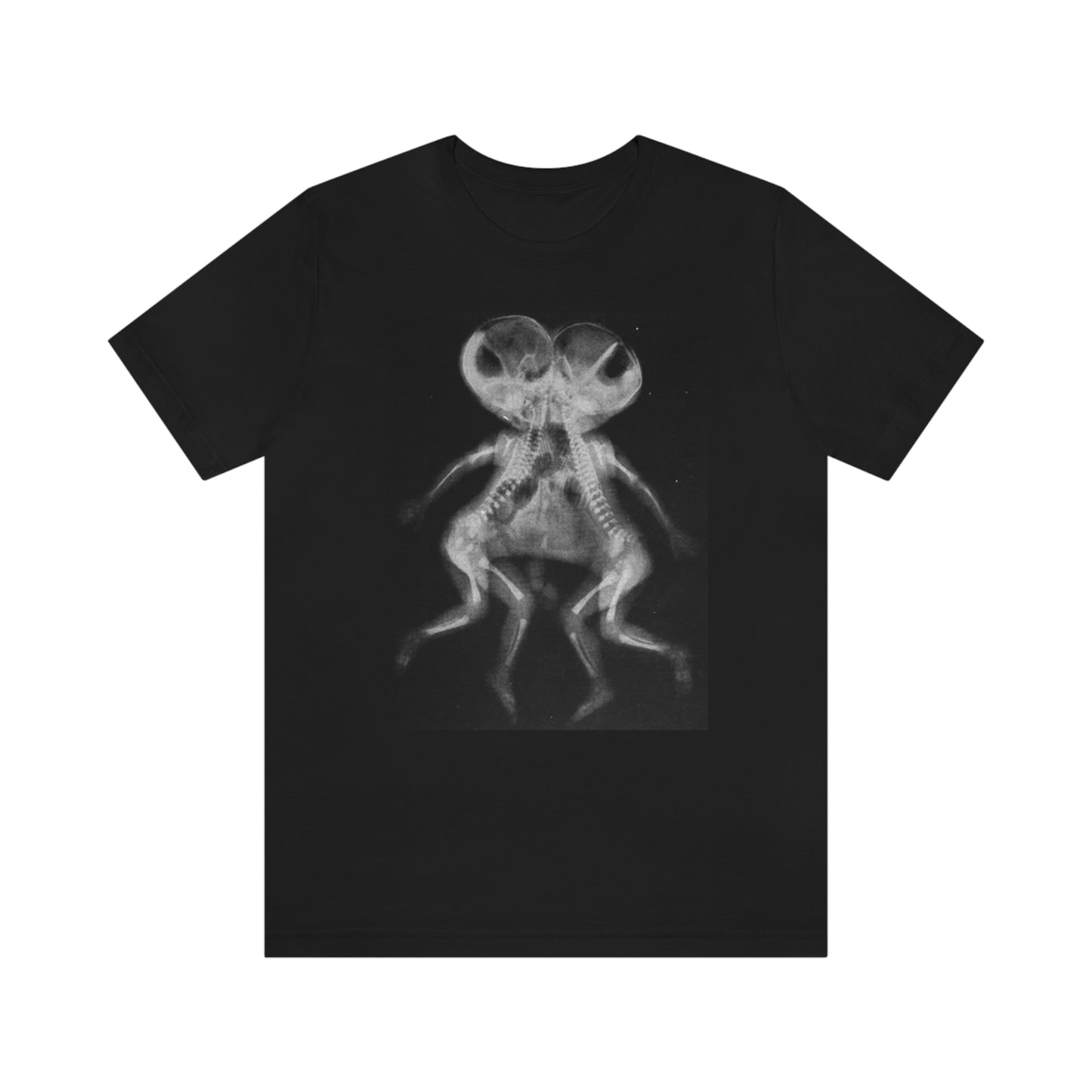 Gothic Punk Sideshow Conjoined Twin Xray shirt Lord and Lady Towers